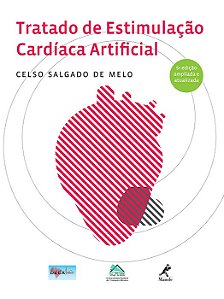 Livro Tratado de Estimulação Cardíaca Artificial