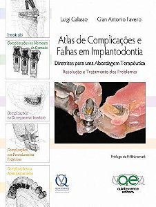 Livro Atlas de Complicações e Falhas em Implantodontia
