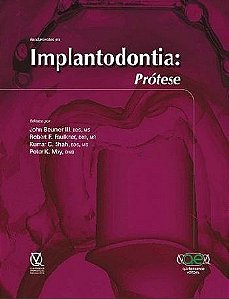 Livro Fundamentos em Implantodontia: Protese - Beumer Iii