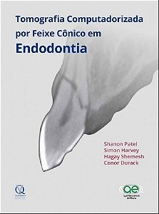 Livro Tomografia Computadorizada por Feixe Conico em Endodontia - Patel/harvey/shemesh