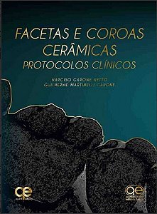 Livro Facetas e Coroas Cerâmicas:  Protocolos Clínicos