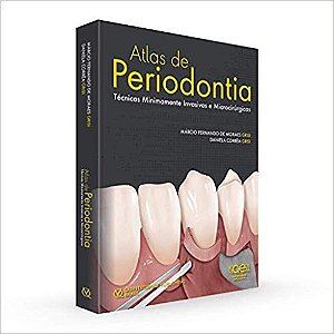 Livro Atlas de Periodontia - Grisi