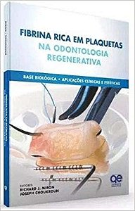 Livro Fibrina Rica Em Plaquetas Na Odontologia Regenerativa - Base Biologica - Miron