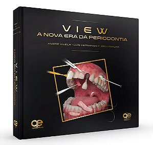 Livro View: a Nova era da Periodontia - Vilela/bellasalma