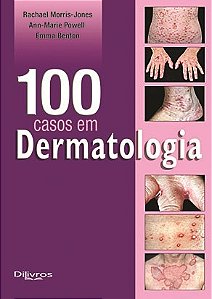 Livro 100 Casos em  Dermatologia