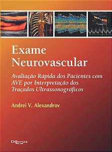 Livro Exame Neurovascular Avaliação Rápida dos Pacientes com Avc