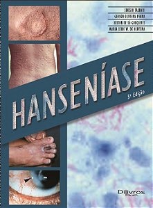 Livro Hanseníase  Talhari