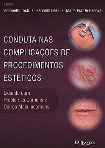 Livro Conduta Nas Complicações de Procedimentos Estéticos  Tosti