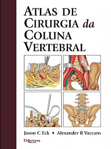 Livro Atlas de Cirurgia da Coluna Vertebral  Vaccaro