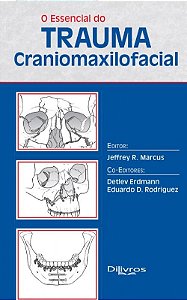 Essencial do Trauma Craniomaxilofacial - Marcus - Dilivros