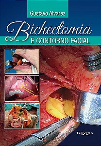 Livro Bichectomia e Contorno Facial  Alvarez