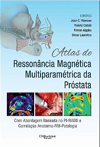 Livro Atlas de Ressonância Magnética Multiparamétrica da Próstata - Vilanova - Dilivros