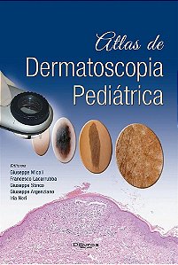 Livro Atlas de Dermatoscopia Pediátrica