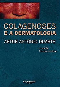 Livro Colagenoses e a Dermatologia Duarte