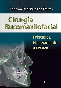 Livro Cirurgia Bucomaxilofacial  Freitas