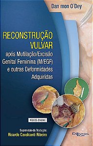 Reconstrução Vulvar com Video - O´dey - Dilivros