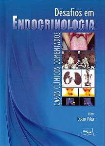 Livro Desafios em Endocrinologia Casos Clínicos Comentados Vilar