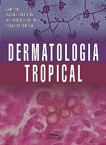 Livro Dermatologia Tropical - Lyon/grossi/castorin