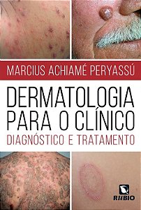 Livro Dermatologia para o Clinico: Diagnostico e Tratamento - Peryassu