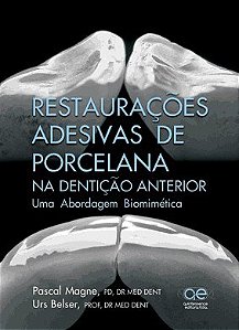 Livro Restauracoes Adesivas de Porcelana Na Denticao Anterior: Uma Abordagem Biom - Magne