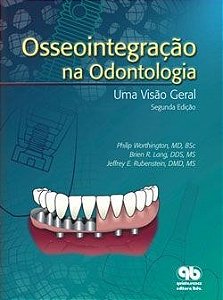 Livro Osseointegração na Odontologia - Worthington - Quintessence