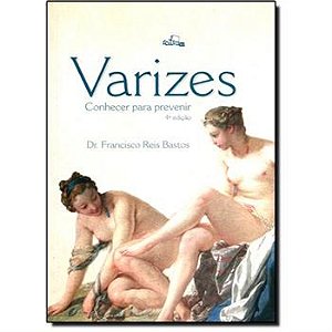 Livro Varizes: Conhecer para Prevenir