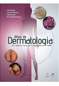 Livro Azulay Atlas de Dermatologia da Semiologia ao Diagnóstico