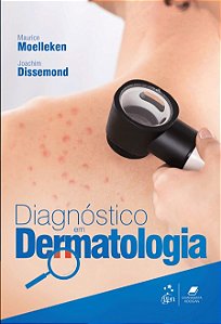 Livro Diagnóstico Em Dermatologia  Moelleken Guanabara