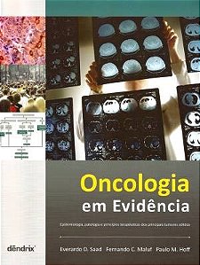 Livro Oncologia em Evidência