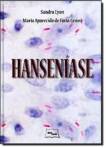 Livro Hanseníase - Lyon - Medbook