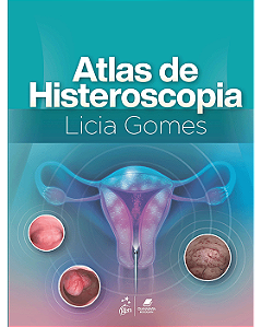 Livro Atlas de Histeroscopia  Gomes