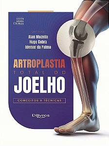 Livro Artroplastia Total do Joelho -Conceitos e Técnicas