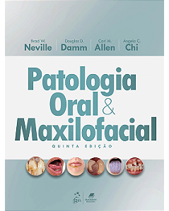 Livro Neville Patologia Oral e Maxilofacial