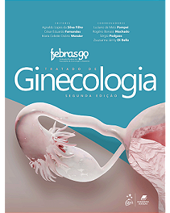 Livro Tratado de Ginecologia Febrasgo