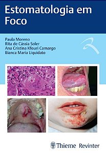 Livro Estomatologia em Foco