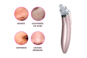 Removedor de Cravos Portátil para Limpeza Facial