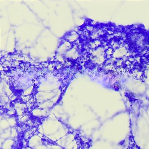 LAMINAS PREPARADAS DE BACTERIAS HUMANAS (CONJUNTO COM 30 LAMINAS)