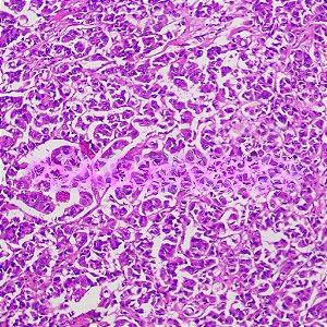 LAMINAS PREPARADAS DE PATOLOGIA HUMANA (CONJUNTO COM 50 LAMINAS)