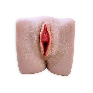 SIMULADOR DE PATOLOGIAS VULVARES NINFOTRAINER - VLV-9 VULVA COM CISTO DE BARTHOLIN E SKENE (CÓD. 3496) (MAT. PEDAG)