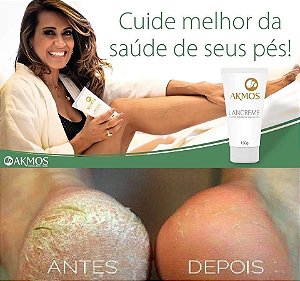 Lancreme -Conquiste os pés que sempre desejou!