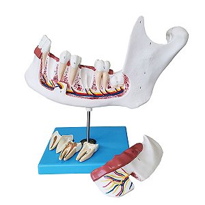 Anatomia do Dente e Mandíbula Inferior de um Jovem 6 Partes