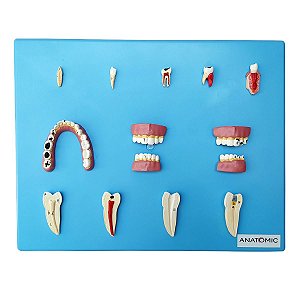 Patologia Dentária em 12 peças - TZJ-0311-P