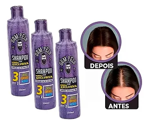 Kit 3 Shampoo Minoxidil Fortificante 3 Em 1 - Dom Pelo 250ml