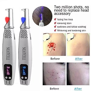 Caneta Laser Remover Tatuagem Original Azul Ou Vermelha