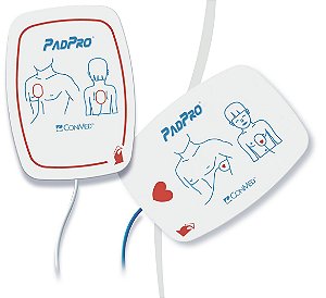 Eletrodo PadPro ConMed compatível com Philips