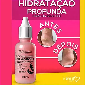 Gota Milagrosa Para Pés - Combate Rachadura E Ressecamento