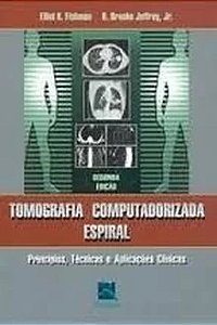 Tomografia Computadorizada Espiral - Princípios, Técnicas e Aplicações - Elliot K. Fishman