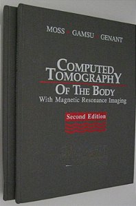 Computed Tomography of the Body - Moss - Vol. 3 - Abdomen