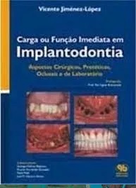 Livro Carga Ou Funcao Imediata Em Implantodontia - Aspectos Cirurgicos, Proteticos, Oclusas E De Laboratorio - Vicente Jimenez Lopes
