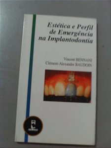 Estética E Perfil De Emergência Na Implantodontia - Vincent Bennani